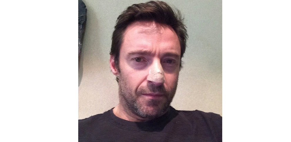 Hugh Jackman.jpg