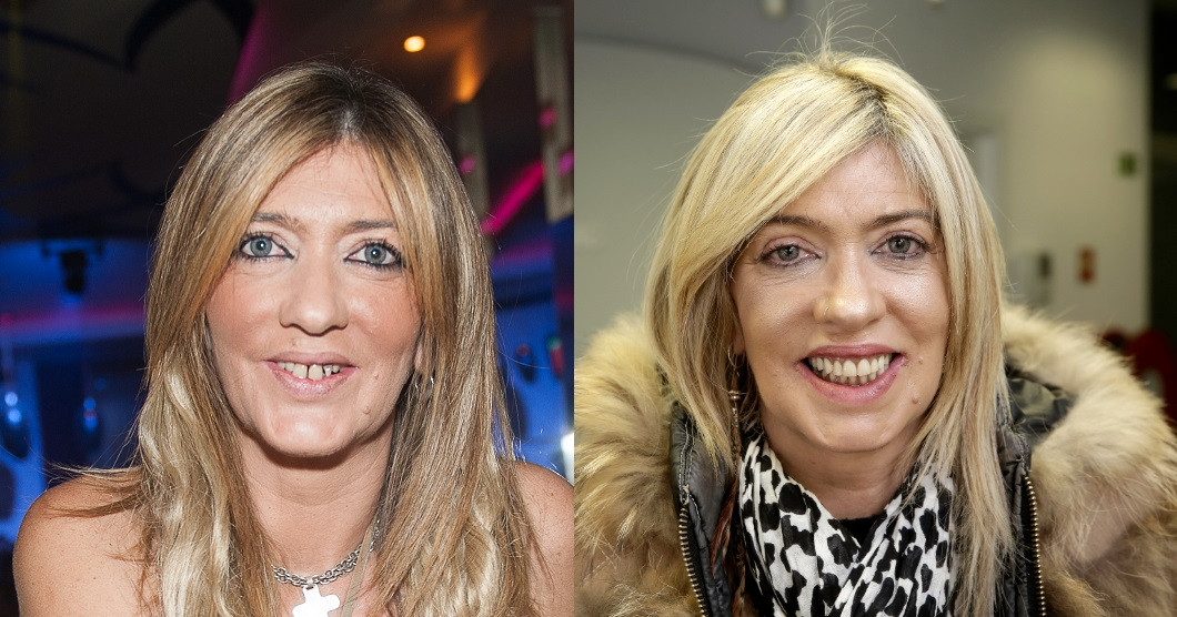 Cirurgia de Maria Leal: os detalhes de uma cirurgia que durou mais de 12 horas