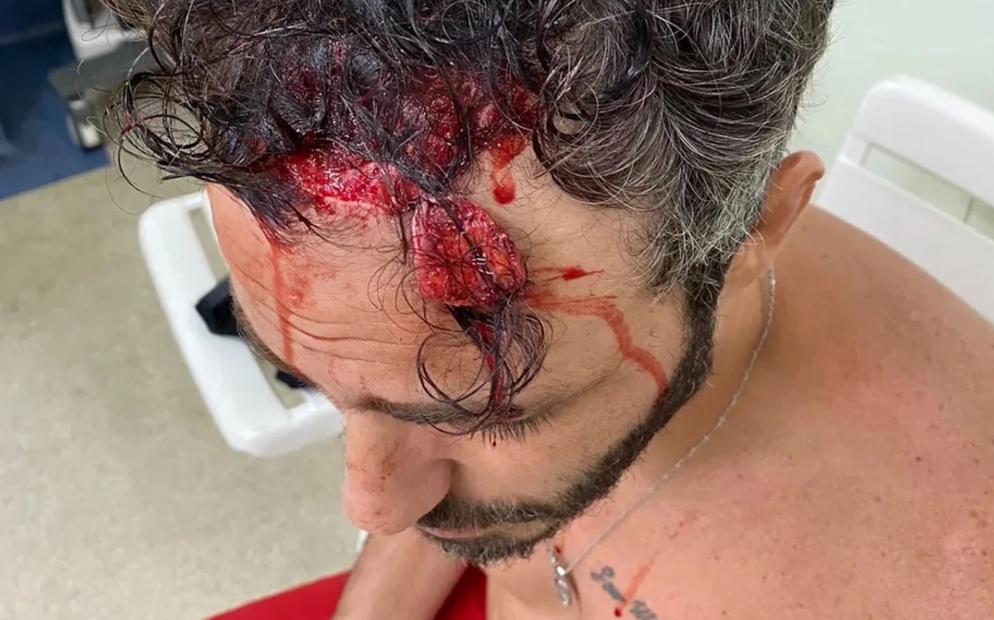 Thiago Rodrigues partilhou com a imprensa brasileira uma imagem do resultado das agressões