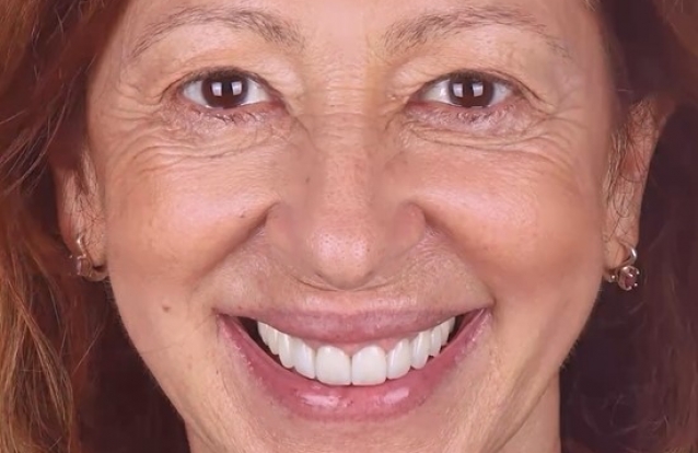 Ana Bustorff tem dentes novos! Parece outra pessoa