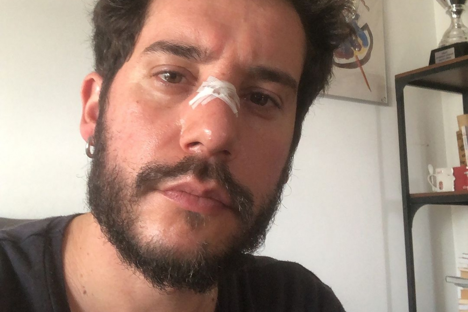 Ricardo de Sá foi assaltado e agredido em Lisboa