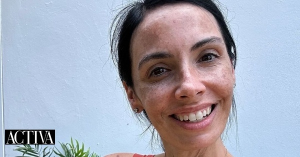 Mia Relógio partilha luta contra a depressão e anorexia