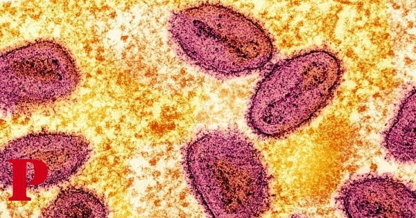 Novos casos de mpox detectados na Alemanha e na Noruega