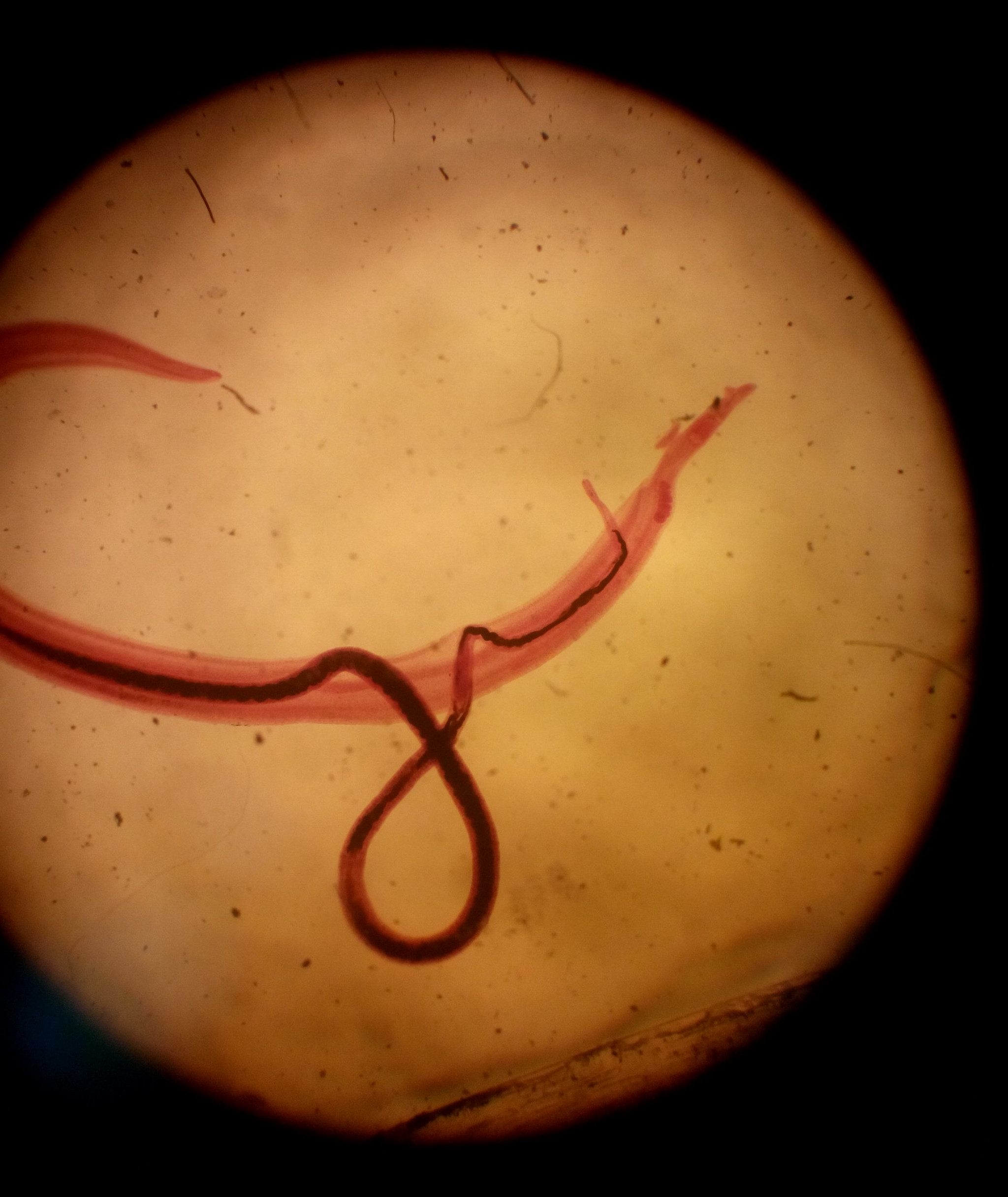parasita esquistossoma microscopio 2.jpg