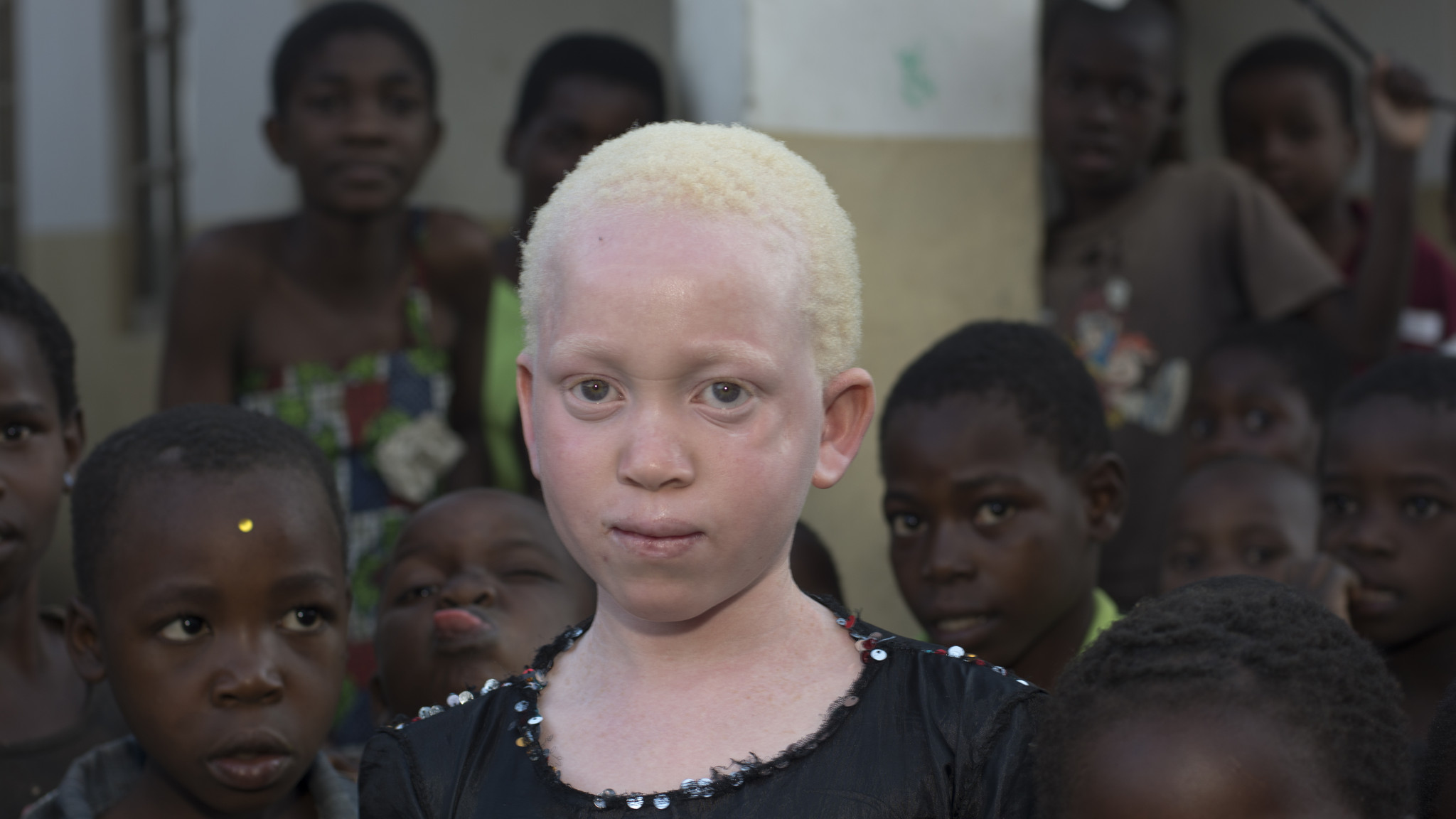 негр и азиат альбинос фото 88