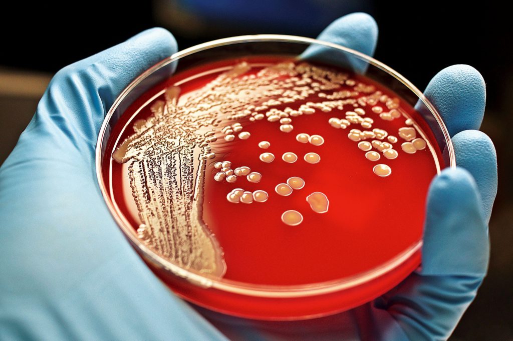 Antibióticos, 90 anos de história 