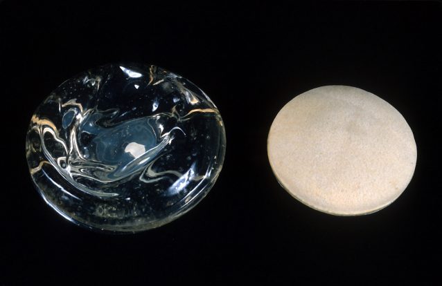Aumentam casos de tipo raro de cancro ligados a implantes mamários
