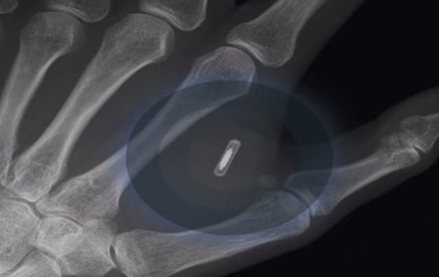 E se a sua empresa lhe implantasse um microchip na mão? Porque um cartão é tão século XX...