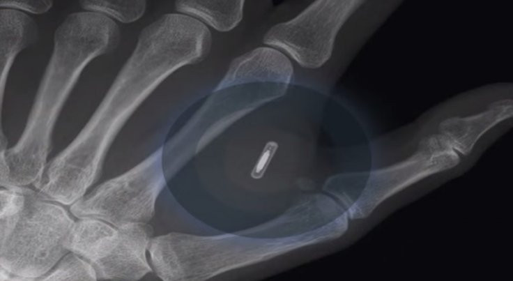 E se a sua empresa lhe implantasse um microchip na mão? Porque um cartão é tão século XX...