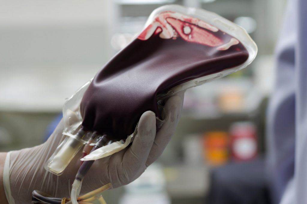 Erro humano contaminou com vírus HIV menina angolana de 7 anos após transfusão de sangue