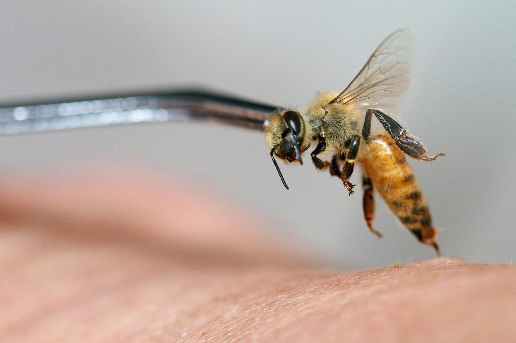 Espanhola morre depois de uma sessão de acupuntura com abelhas