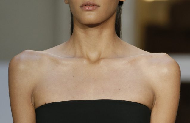 Estudo revela que anorexia nervosa pode ter causas genéticas