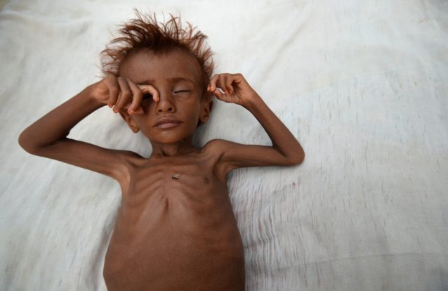 Fome em África: 1,4 milhões de crianças podem morrer nos próximos meses