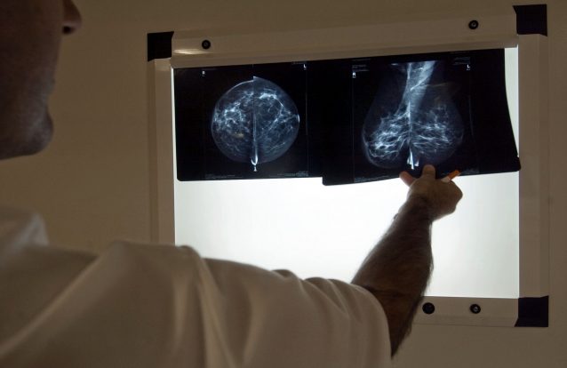 Liga gastou 800 mil euros a apoiar doentes com cancro carenciados no ano passado