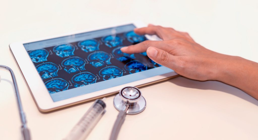 LSD e outras substâncias alucinogénias podem ser "próxima geração" de tratamentos para transtornos mentais