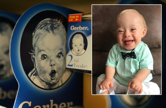 Lucas, bebé do ano e... portador de trissomia 21