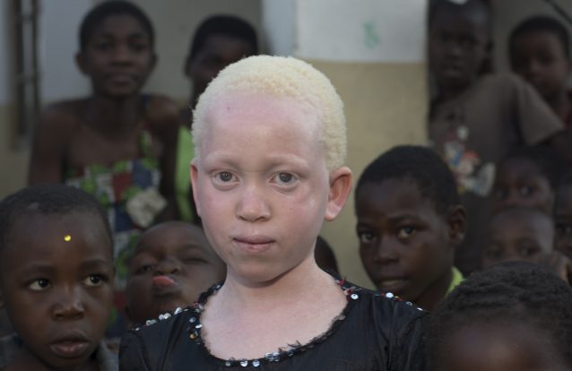 Mande uma carta pela luta dos direitos humanos