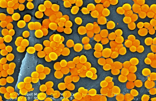 O que diz que uma infeção comum está a evoluir para uma potencialmente fatal sépsis? Encontrada a resposta e pode salvar milhares