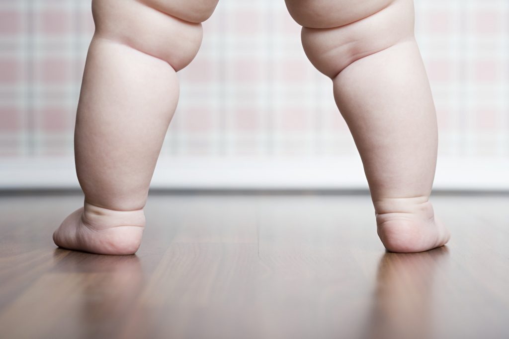 Obesidade infantil pode aumentar número de casos de asma