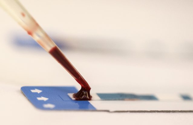 Portugal é um dos países europeus mais bem sucedidos na luta contra a sida