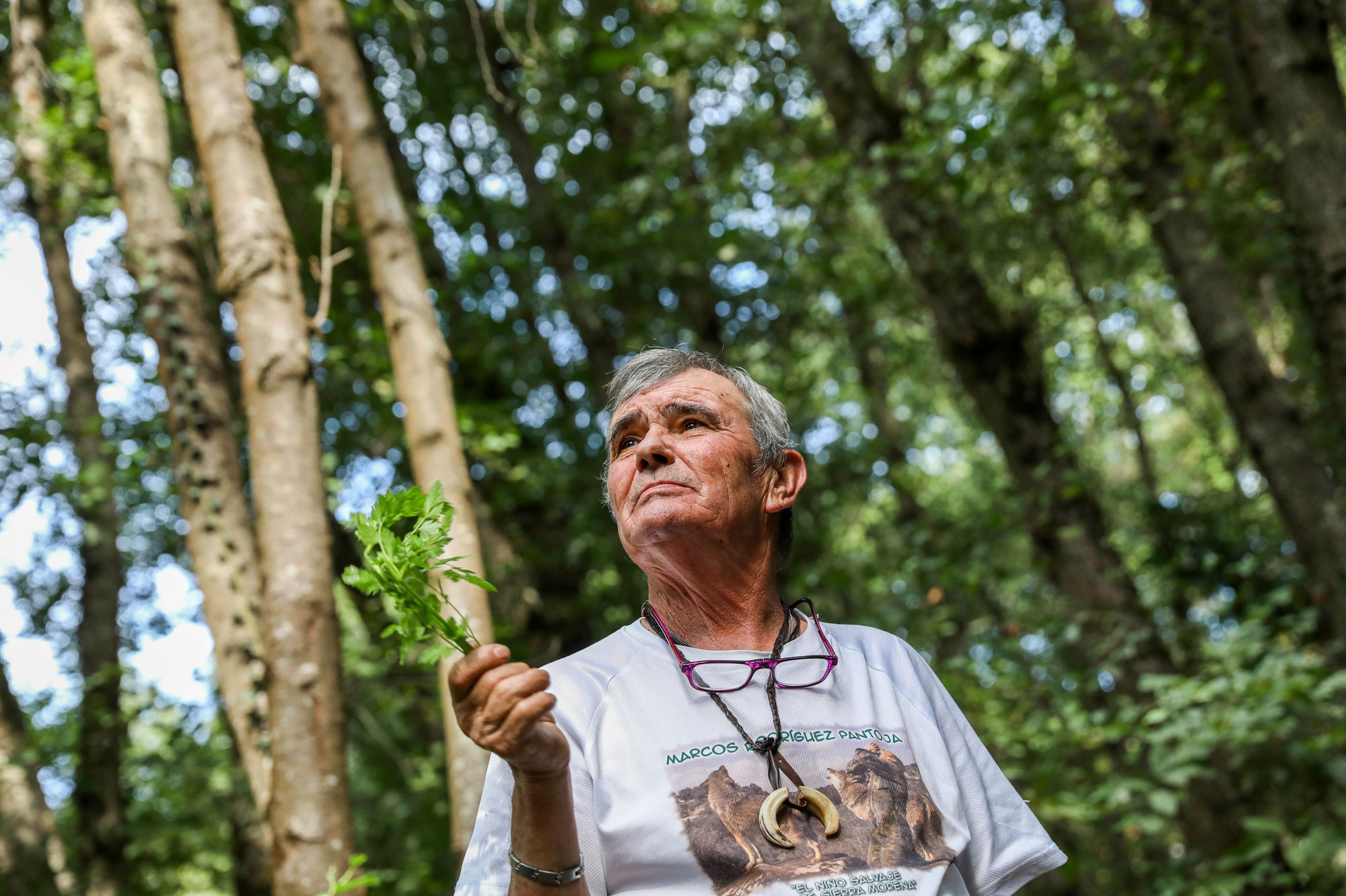 Visão Reportagem A nova vida do homem-lobo