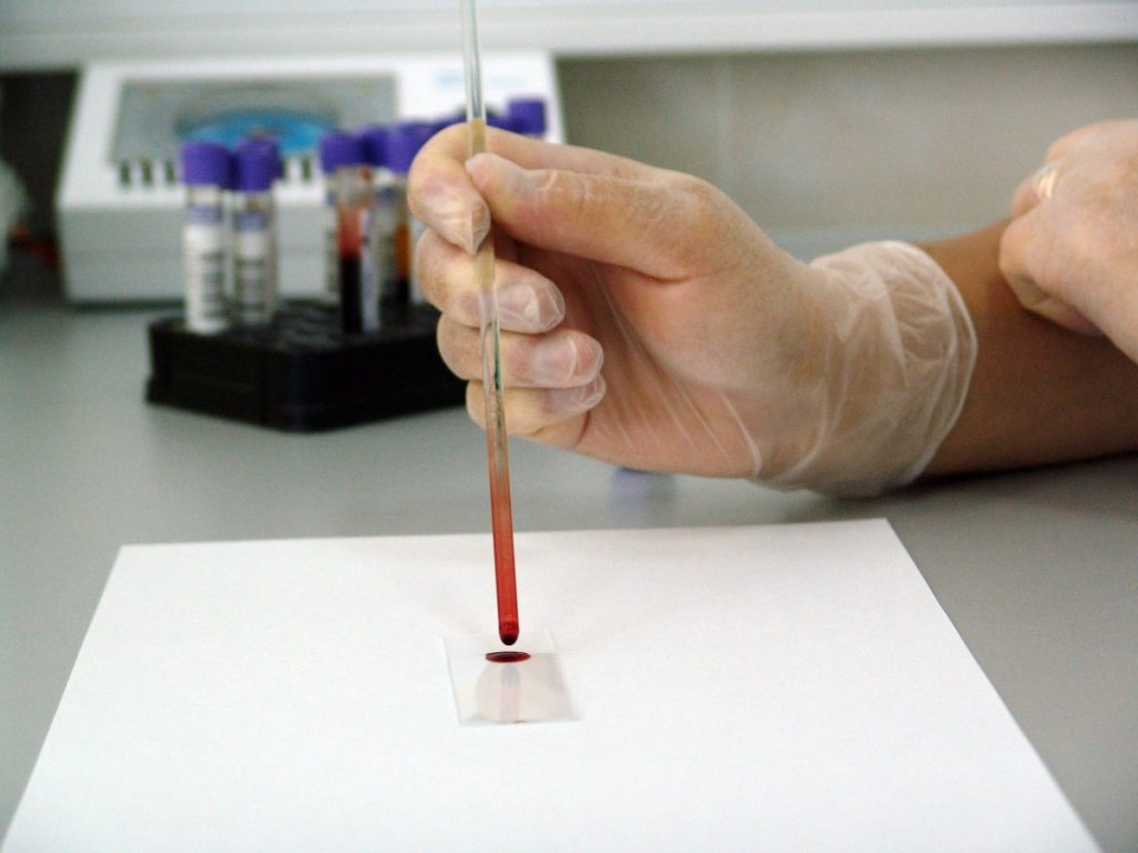 Vai entrar em fases de ensaios clínicos uma vacina que ataca o tumor e as metástases de uma só vez
