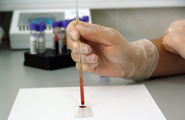Vai entrar em fases de ensaios clínicos uma vacina que ataca o tumor e as metástases de uma só vez