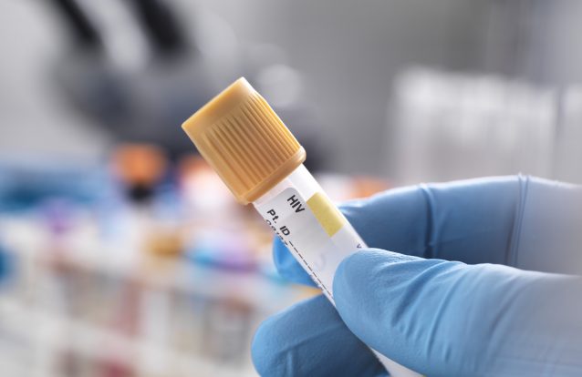 VIH em mutação pode tornar inúteis medicamentos antirretrovirais