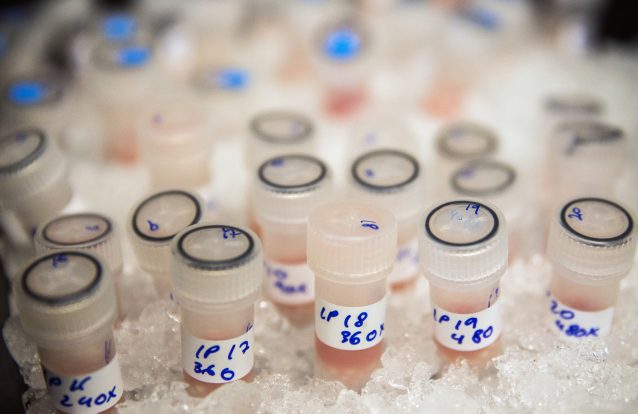 Vírus da gripe modificado com potencial para combater o agressivo cancro do pâncreas