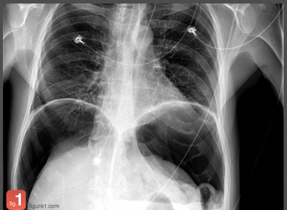 Está preparado para espreitar o Instagram dos médicos? 13