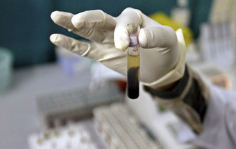 Alguns glóbulos brancos contribuem para cancro do ovário