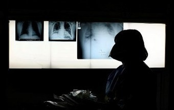 AMI pede radiografias usadas para financiar centro social