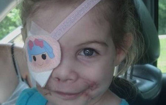 Cirurgião oferece tratamento a menina expulsa de restaurante por ter cicatrizes no rosto