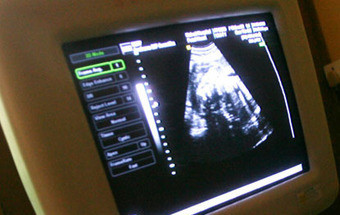 Clínica ilegal na Amadora disponibiliza-se para fazer abortos