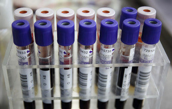 Doação de sangue por homossexuais: Grupo de trabalho chegou a acordo