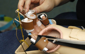 Jovem recebe transplante total de mão