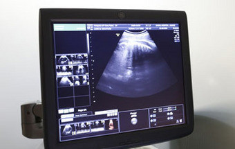 Pioneiro da FIV alerta que tratamentos de fertilidade ameaçam humanidade