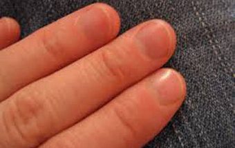 Pode a medida do dedo indicador revelar se é fiel ou infiel?