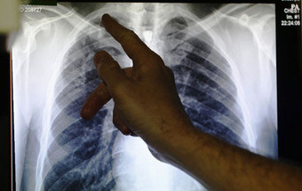 Radiologia: Doentes em risco