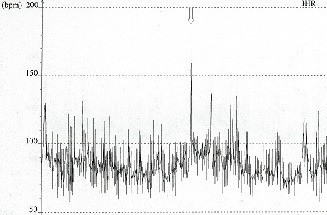 Um milhão de euros para projetos de cardiologia e 150 mil para psiquiatria