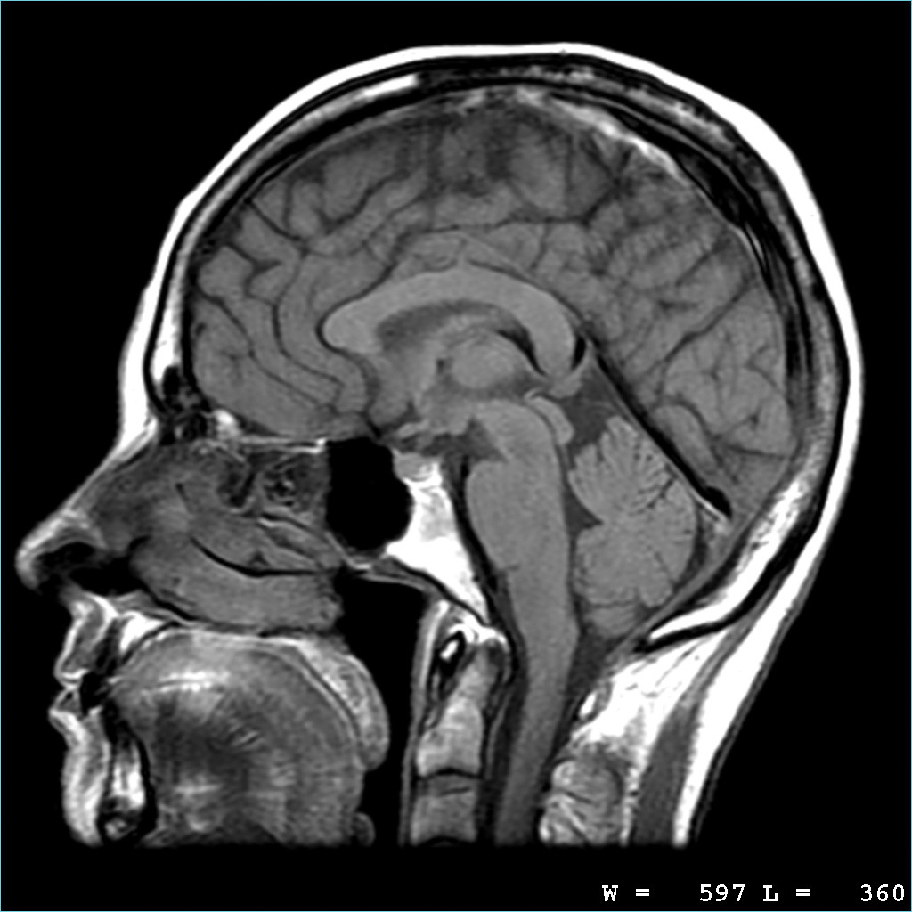 mri.jpg
