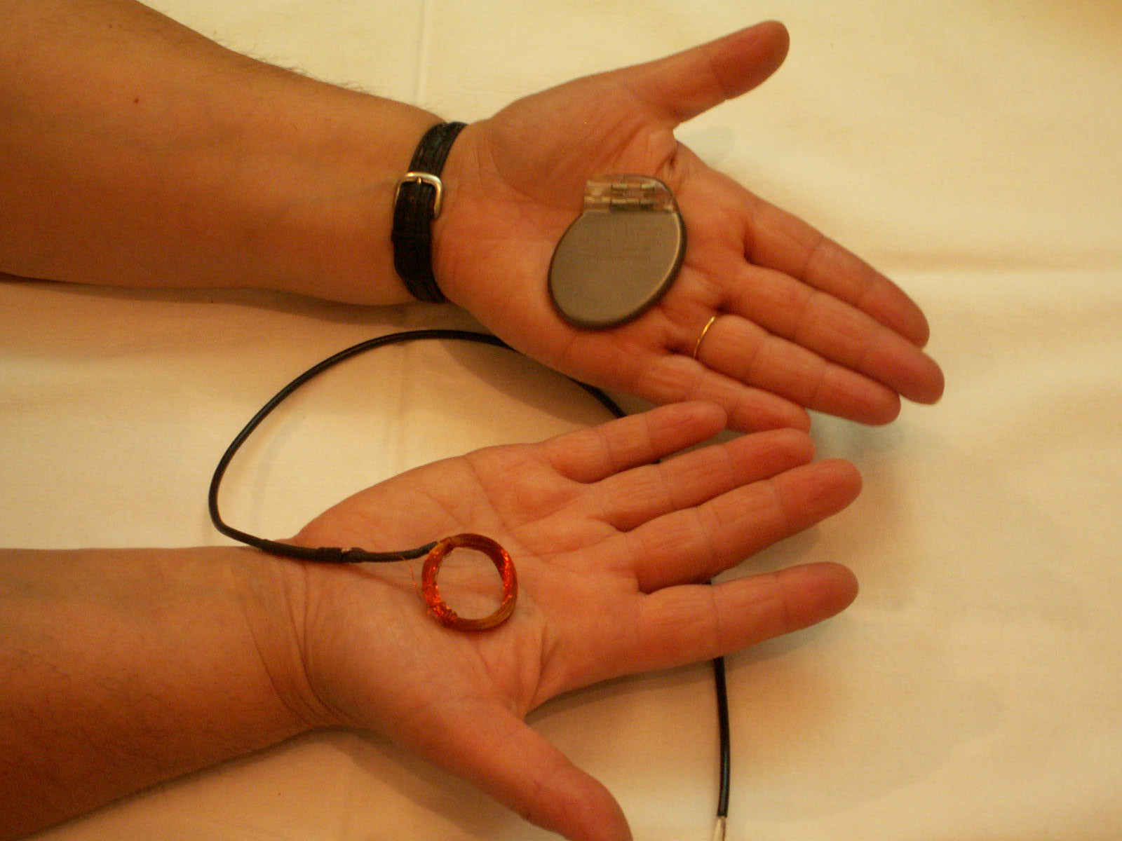 A pacemaker device and an implantable coil prototype.jpg