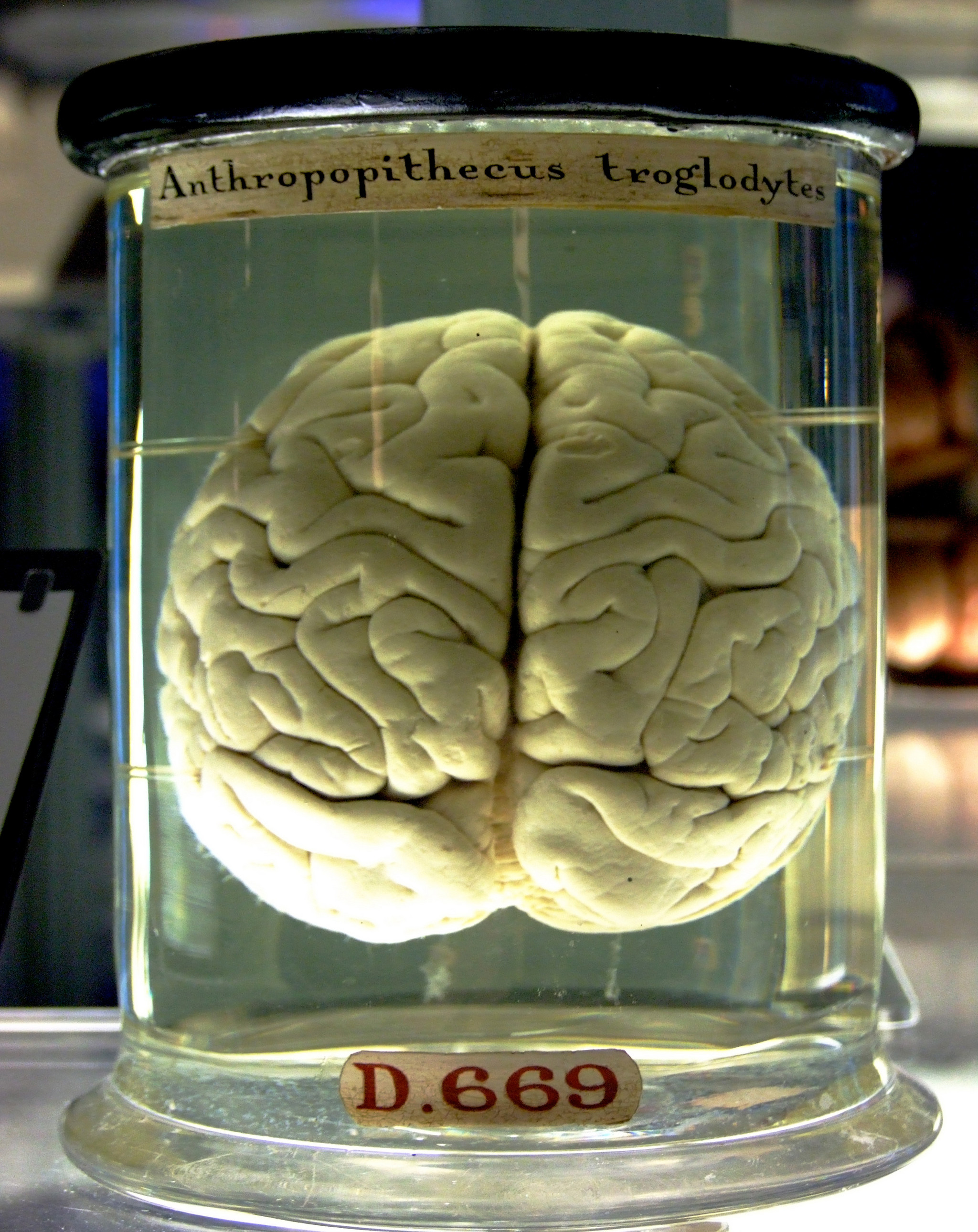 cerebro.jpg
