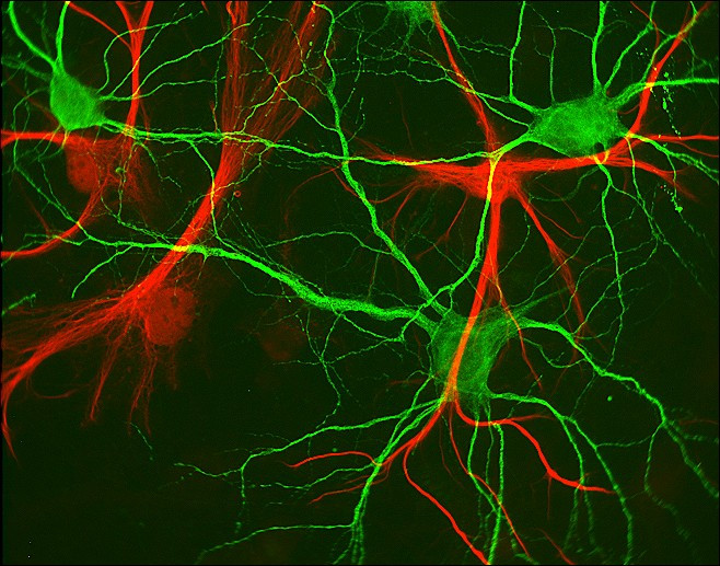 glial-cells.jpg