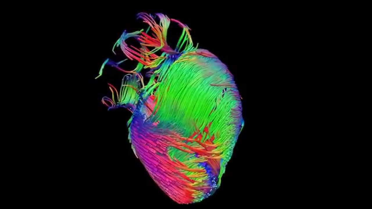 MRI coração.jpg