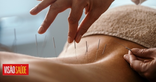 A acupunctura não tem benefícios para a saúde, conclui novo estudo