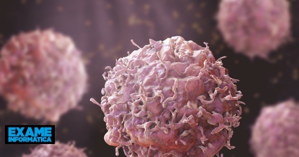 Inteligência Artificial consegue prever eficácia de quimioterapia contra cancro da mama