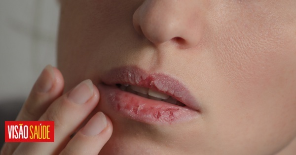 Lábios secos: Os batons do cieiro podem fazer ainda pior? A resposta de especialistas