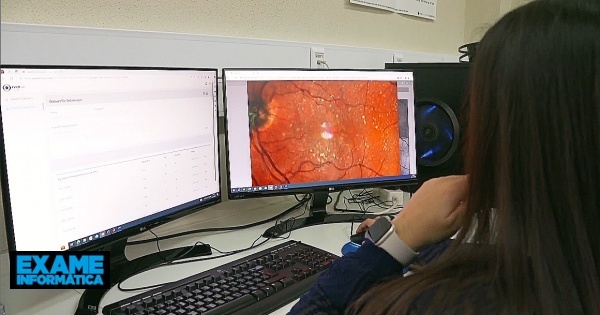 CGI desenvolve plataforma para AIBILI na área de investigação oftalmológica