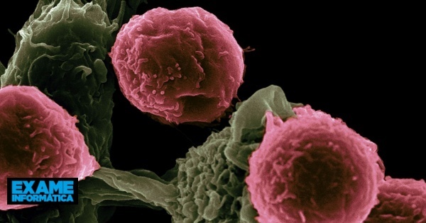 Detetar cancro com sete anos de antecedência? Cientistas descobrem proteínas no sangue com esse potencial